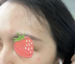 点击看大图 体验后-维秘形体医美 M·VVON医生集团