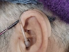 -自然之声助听器·呼吸机(公园路店)