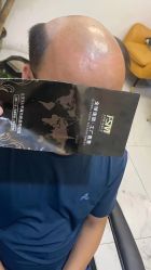 -发饰美男士增发补发假发定制店