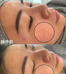 -SKIN79皮肤管理中心