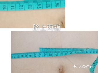 科普一下，产后腹直肌分离的原因大家可以了解一下：