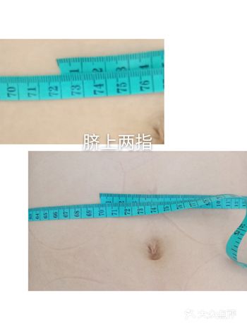 科普一下,产后腹直肌分离的原因大家可以了解一下: