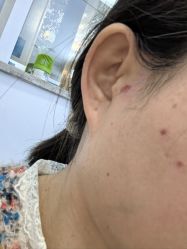 -宁波美莱整形美容