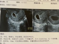 -上海艾儿贝佳妇产科医院