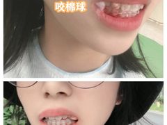 -团圆口腔·种植中心(锦江院区)