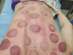 -张钰强中医正骨推拿连锁(唐家人才公寓店)
