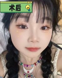 -素美医疗美容·西南眼鼻整形·修复基地