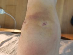 -复旦大学附属华山医院(浦东院区)