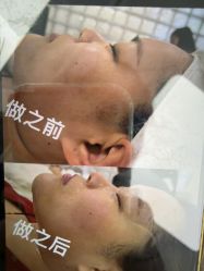 -杭州米兰柏羽医疗美容医院