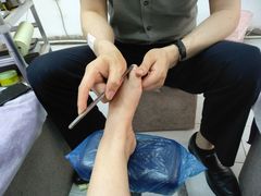 -祖传修脚甲沟炎灰指甲鸡眼