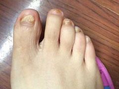 -新甲连锁灰指甲·甲沟炎·鸡眼(黑龙江路店)