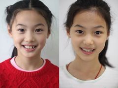 -Dr.Z dental仁康种植矫正中心