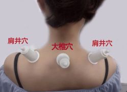 点击看大图 -升艾堂亚健康调理中心