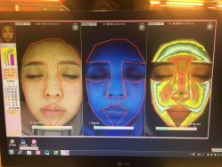 皮肤检测-光SPA科技美肤