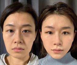 -LUNA皮相美·骨相美高级美感