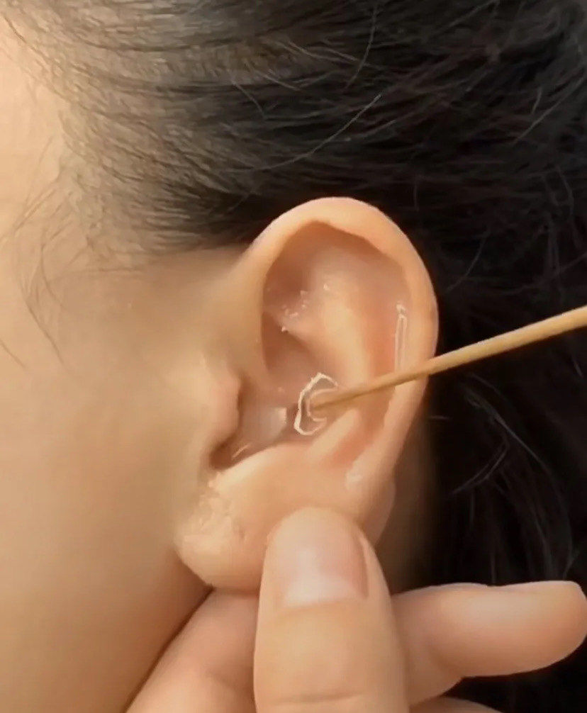 给耳朵洗个澡吧