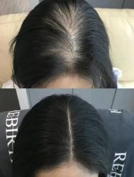 -希梵尔头皮抗衰·科技养发
