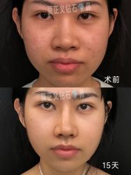 -北京米扬丽格医疗美容·联合丽格鼻整形中心