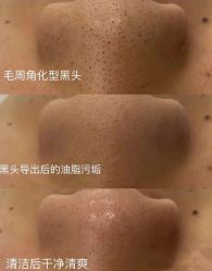 -美愈美肤MEIYU SKIN