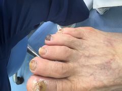-Andrew指甲专科灰指甲·甲沟炎矫正·3D步态矫形鞋垫定制(浦三路店)