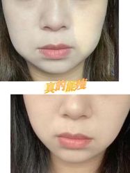 -至简医疗美容·医生集团