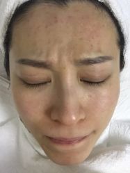 -痘博士北京·全国连锁祛痘机构
