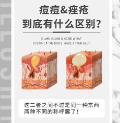 -苗方清颜痘肌研究所