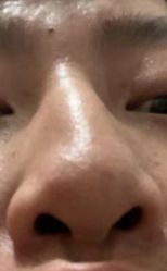 -厦门美莱整形美容医院