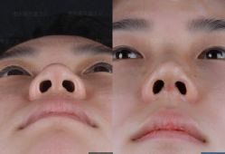 -北京米扬丽格医疗美容·联合丽格鼻整形中心