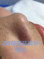 点击看大图 -玫莉蔻皮肤管理中心
