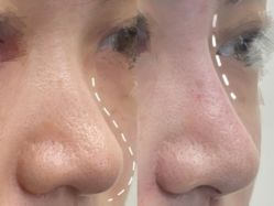 -Yestar重庆艺星医疗美容医院