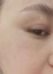 体验后-坤如玛丽·医疗美容中心