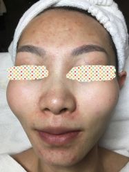 -皇族养心堂·净痘·修敏·御颜