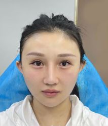点击看大图 体验后-Yestar艺星医疗美容医院