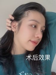 -广州美莱医疗美容医院