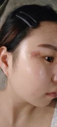 -正璞医疗美容·皮肤修复·微整注射