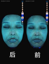 -AURAS璈然科技护肤中心