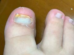 -新甲连锁灰指甲·甲沟炎·鸡眼(黑龙江路店)