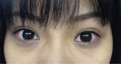 隐形眼线-平萍纹绣韩式半永久定妆