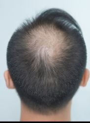 -唐风采假发补发定制