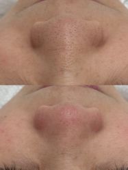 -禾壹净·素颜美问题肌肤修护中心