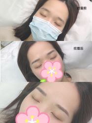 -久匠半永久纹眉