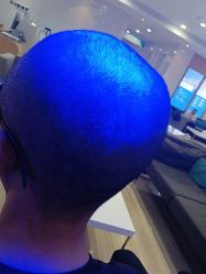 -雍禾植发全国连锁