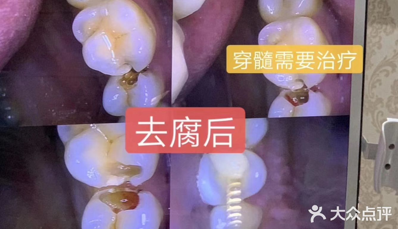 儿童牙科知识必知