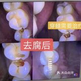 儿童牙科知识必知