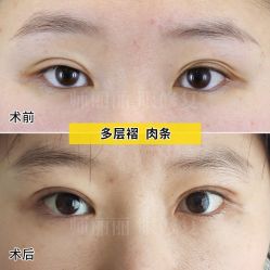 -丰联丽格医疗美容·联合丽格眼整形中心