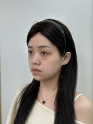 -宁波美莱整形美容