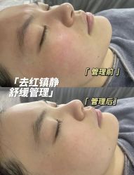 -Cream88颜皮肤管理中心