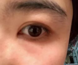 -紫洁俪方（北京）医疗美容