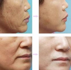 -北京米扬丽格医疗美容·联合丽格鼻整形中心